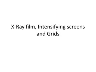 Understanding X-Ray Film: Components and Photosensitivity