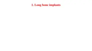 Understanding Long Bone Implants and Osteosynthesis Techniques