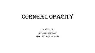 Understanding Corneal Opacity and Its Causes in Eye Health
