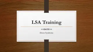 Understanding Down Syndrome: History, Characteristics & Facts