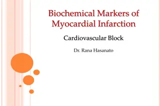 Understanding Biochemical Markers of Myocardial Infarction