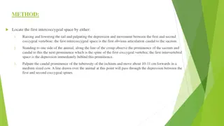 Coccygeal Space Localization and Anesthesia Administration Techniques