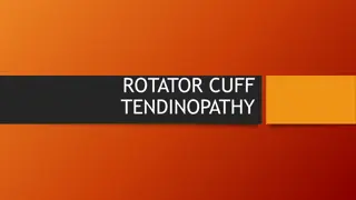 Understanding Rotator Cuff Tendinopathy and Treatment Options