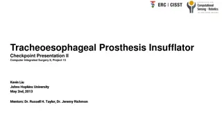 Tracheoesophageal Prosthesis Insufflator Project at Johns Hopkins University 2013 - Overview and Progress Update