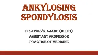 Understanding Ankylosing Spondylitis: Symptoms, Diagnosis & Treatment