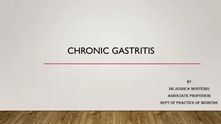 Understanding Chronic Gastritis: Causes, Symptoms, and Treatment