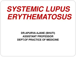 Understanding Systemic Lupus Erythematosus (SLE)