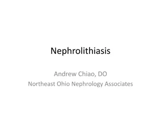 Understanding Nephrolithiasis: Risk Factors & Clinical Features