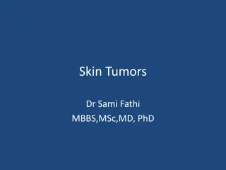 Understanding Skin Tumors and Skin Cancer