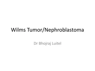 Wilms Tumor - Overview, Risk Factors, and Genetics