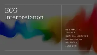 Understanding ECG Interpretation Basics