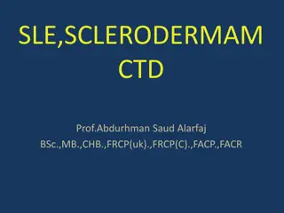 Understanding Systemic Lupus Erythematosus (SLE) Criteria and Diagnosis