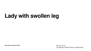 Understanding Leg Swelling Causes and Management