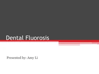 Understanding Dental Fluorosis and its Treatment