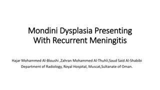 Recurrent Meningitis in Mondini Dysplasia