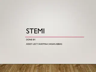 STEMI Treatment Guidelines and Management