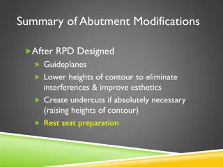 Abutment Modifications Guide for RPD Design
