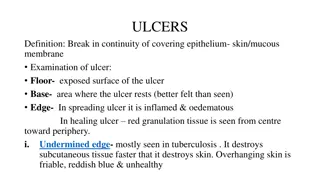 Understanding Ulcers: Examination and Classification