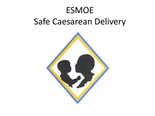 Understanding Safe Caesarean Delivery in South Africa
