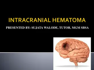 Understanding Intracranial Hemorrhage: Types, Causes, and Symptoms