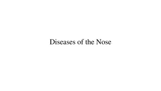 Diseases and Deformities of the Nose