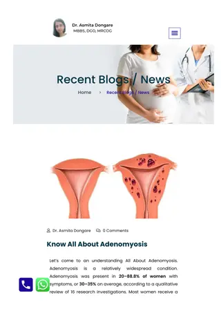 Know All About best adenomyosis treatment