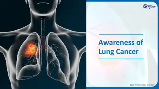 Understanding Lung Cancer Screening Programs and Criteria