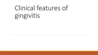 Understanding Clinical Features and Types of Gingivitis