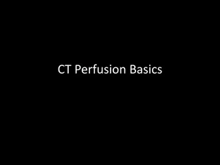 Understanding Basic CT Perfusion Terms in Stroke Imaging