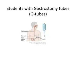 Understanding Gastrostomy Tubes (G-tubes) in Students
