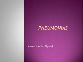 Understanding Pneumonia: Causes, Classification, and Risk Factors