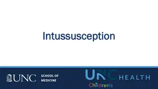 Intussusception