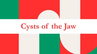 Overview of Jaw Cysts: Classification and Clinical Features