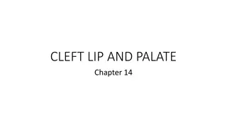 Understanding Cleft Lip and Palate: Causes, Effects, and Management