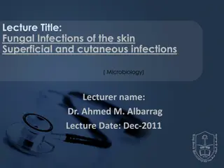Overview of Superficial Fungal Infections of the Skin