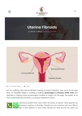 Uterine Fibroids-Symptoms Causes and Treatment