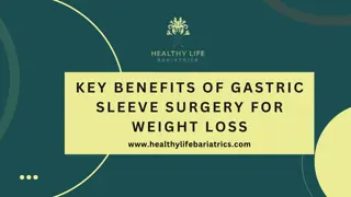 Key Benefits of Gastric Sleeve Surgery for Weight Loss