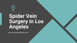 Moein Surgical Arts Spider Vein Surgery in Los Angeles